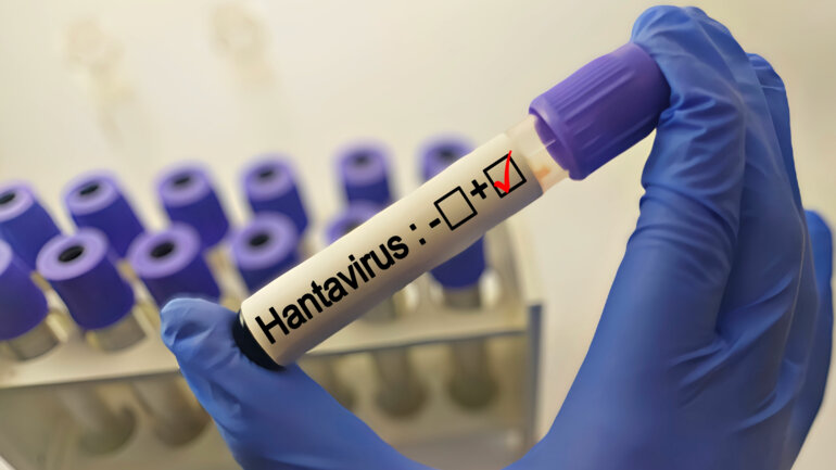 L'Hantavirus n'est pas un nouveau Covid