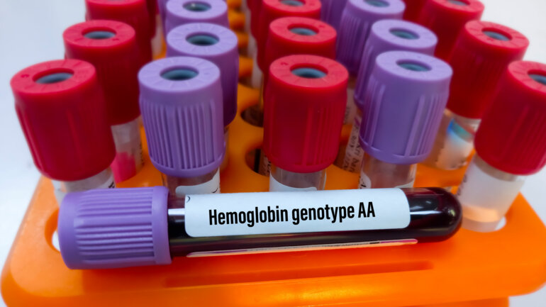 Lutter plus efficacement contre la drépanocytose 