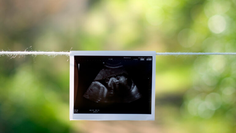 Une grossesse mieux surveillée